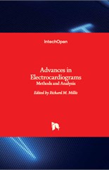 Advances in Electrocardiograms: Methods and Analysis