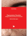 Pigmentation Disorders: Etiology and Recent Advances in Treatments