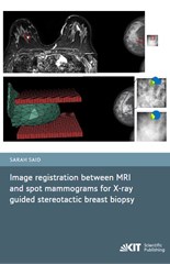 Image registration between MRI and spot mammograms for X-ray guided stereotactic breast biopsy