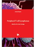 Peripheral T-cell Lymphomas