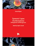 Systemic Lupus Erythematosus: Pathogenesis and Management