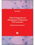 Clinical Diagnosis and Management of Squamous Cell Carcinoma