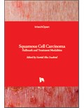 Squamous Cell Carcinoma: Hallmark and Treatment Modalities