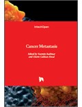 Cancer Metastasis