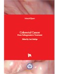 Colorectal Cancer: From Pathogenesis to Treatment