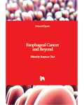 Esophageal Cancer and Beyond