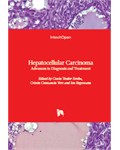Hepatocellular Carcinoma: Advances in Diagnosis and Treatment