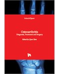 Osteoarthritis: Diagnosis, Treatment and Surgery