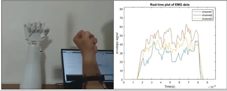 Nghiên cứu, thiết kế, chế tạo mô hình cánh tay robot sử dụng cảm biến EMG kết hợp logic mờ trợ giúp người khuyết tật
