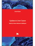 Updates in Liver Cancer