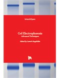 Gel Electrophoresis: Advanced Techniques