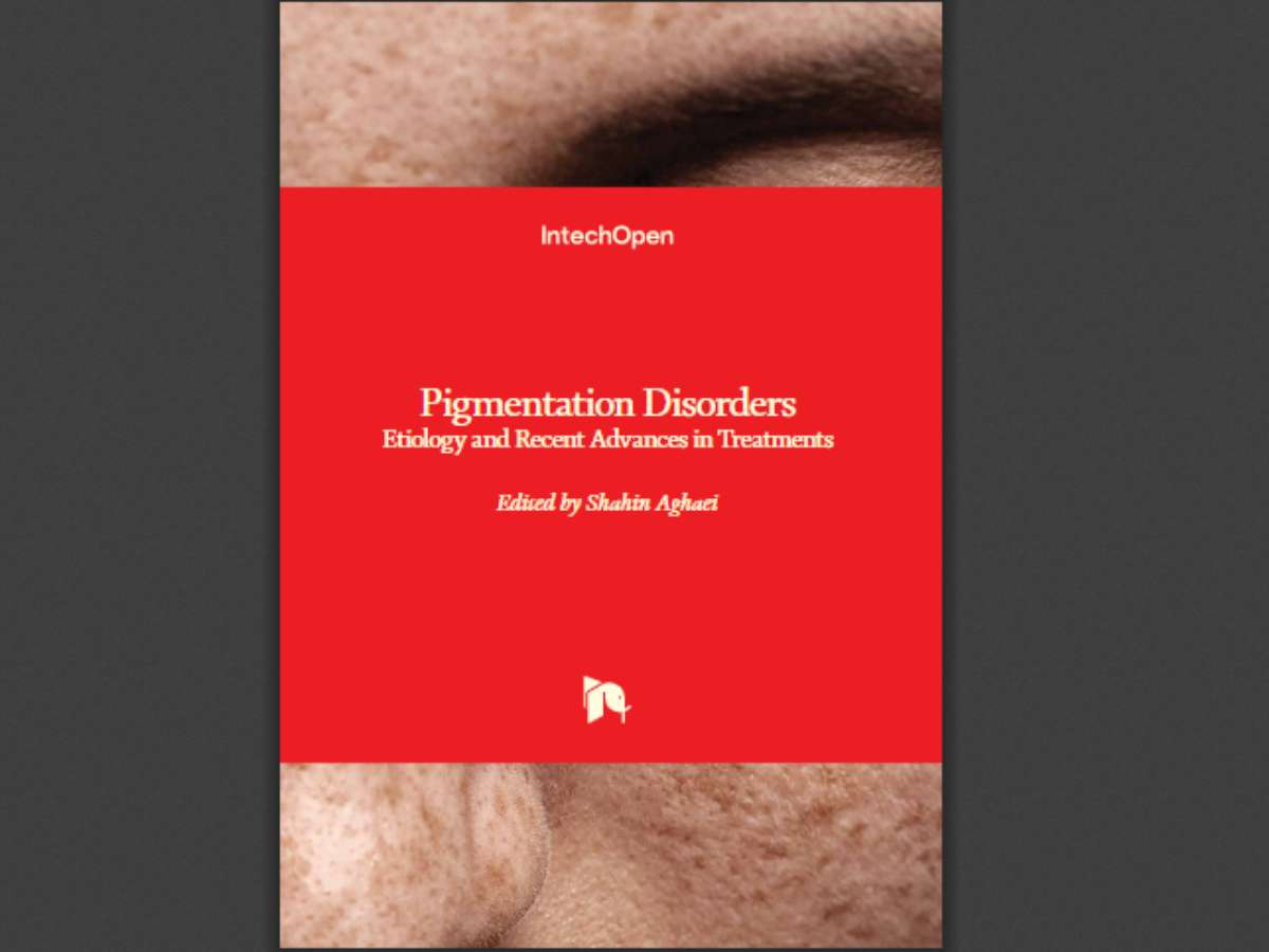 Pigmentation Disorders: Etiology and Recent Advances in Treatments