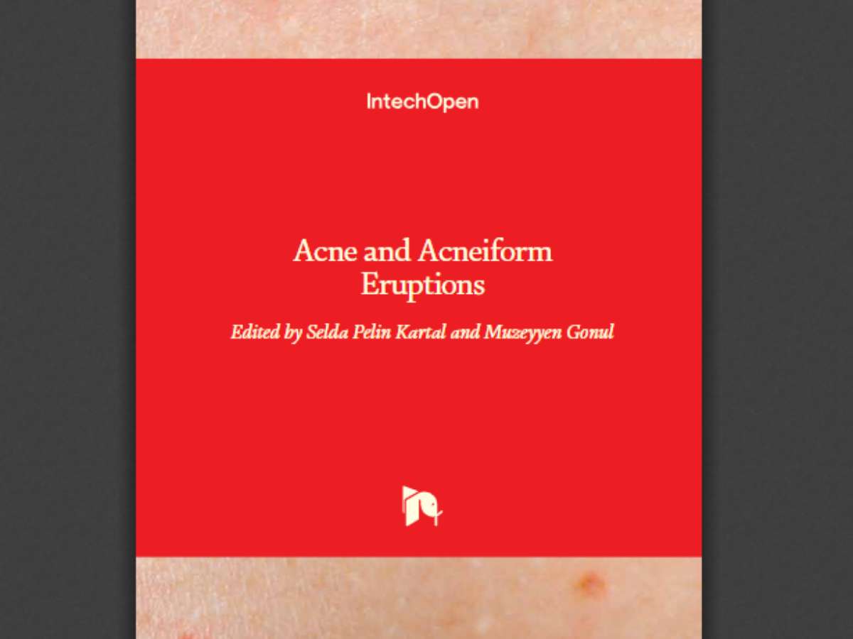 Acne and Acneiform Eruptions