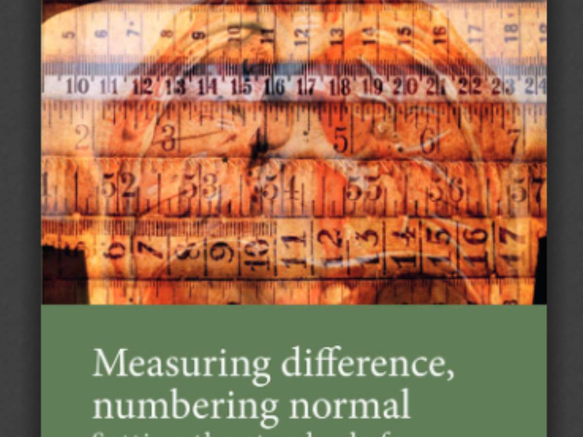 Measuring difference, numbering normal: Setting the standards for disability in the interwar period