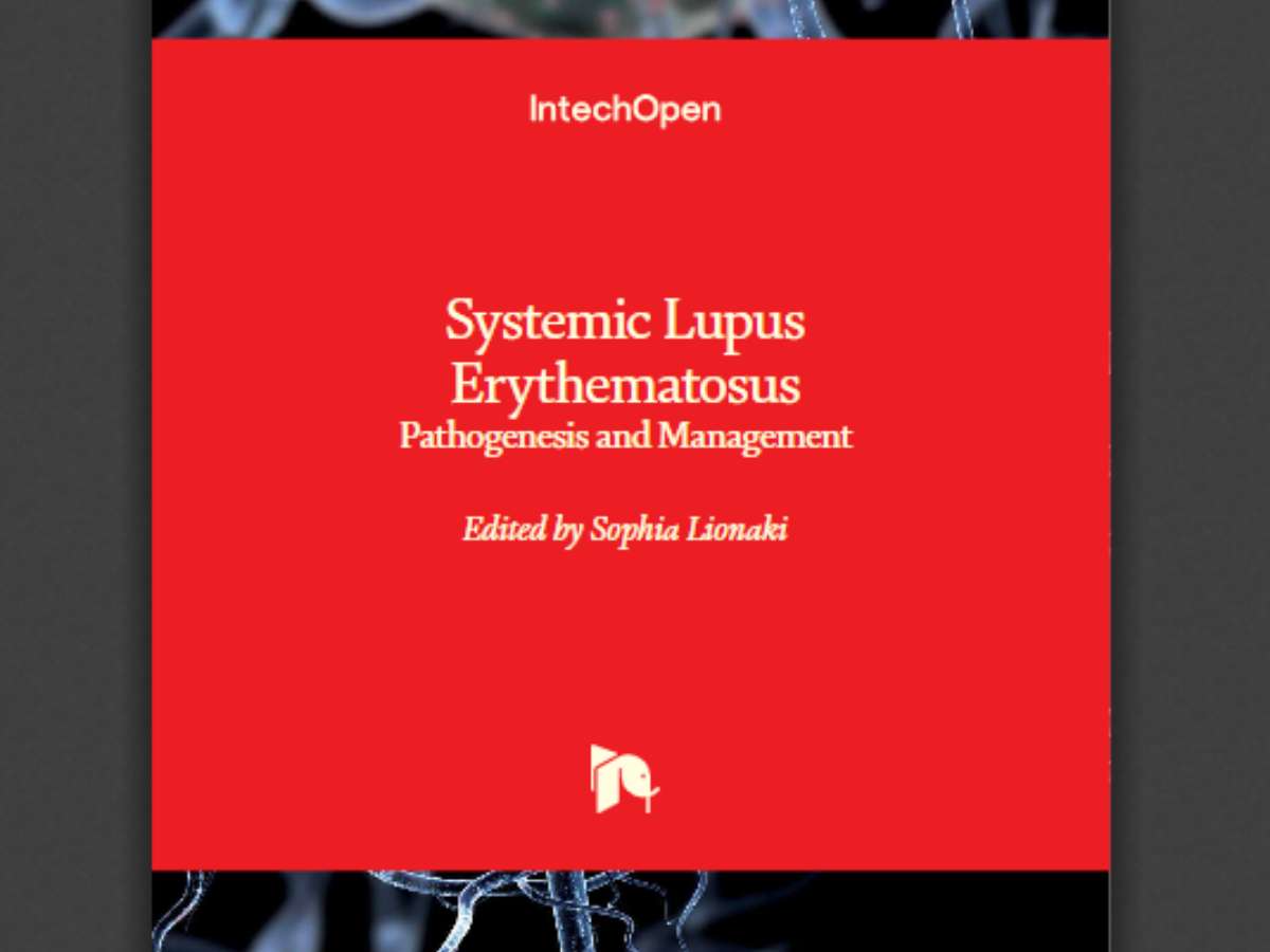 Systemic Lupus Erythematosus: Pathogenesis and Management