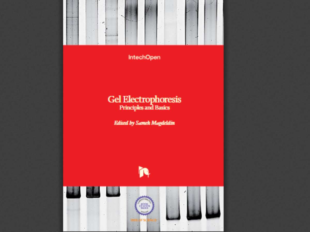 Gel Electrophoresis: Principles and Basics
