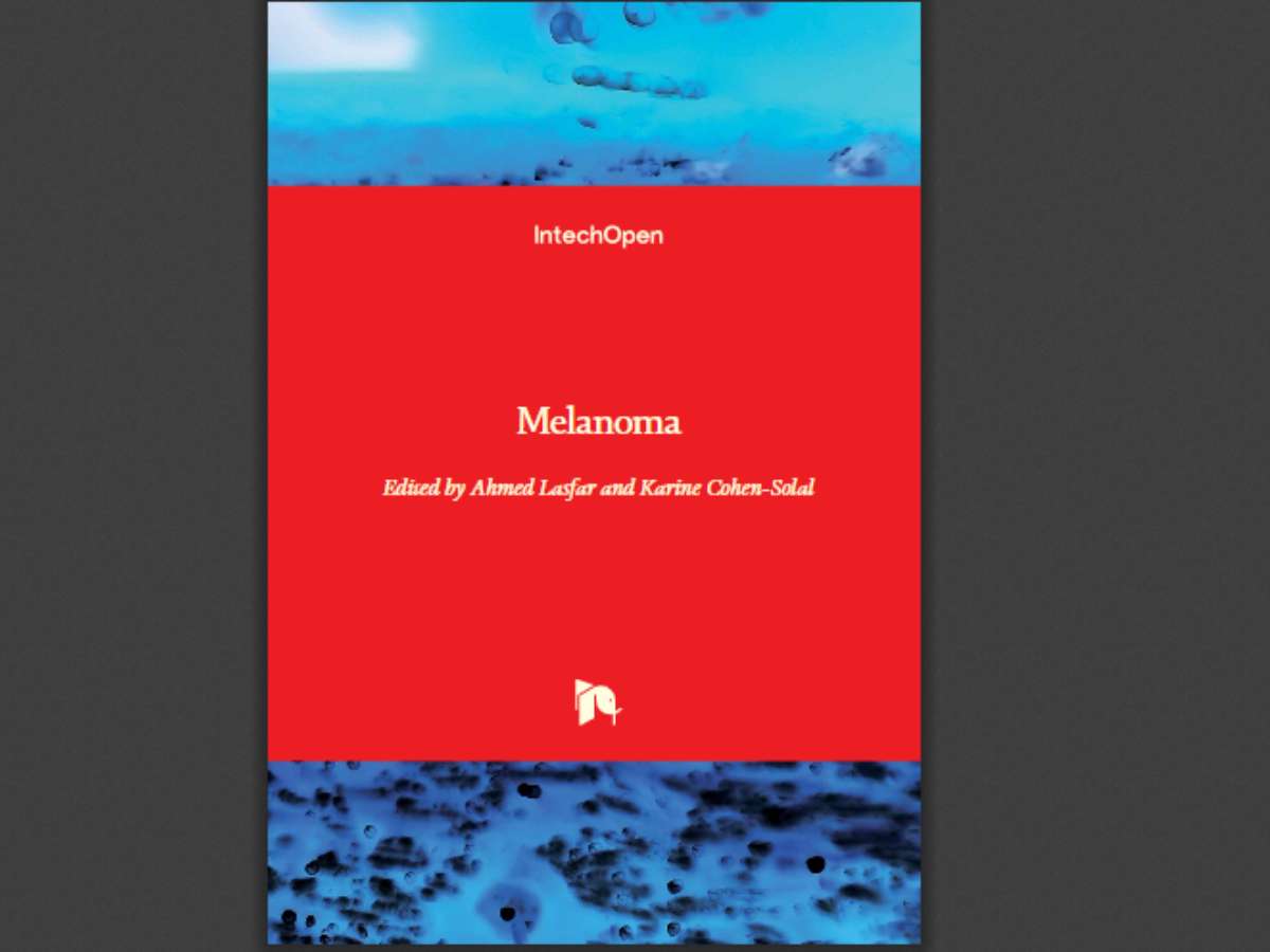 Melanoma