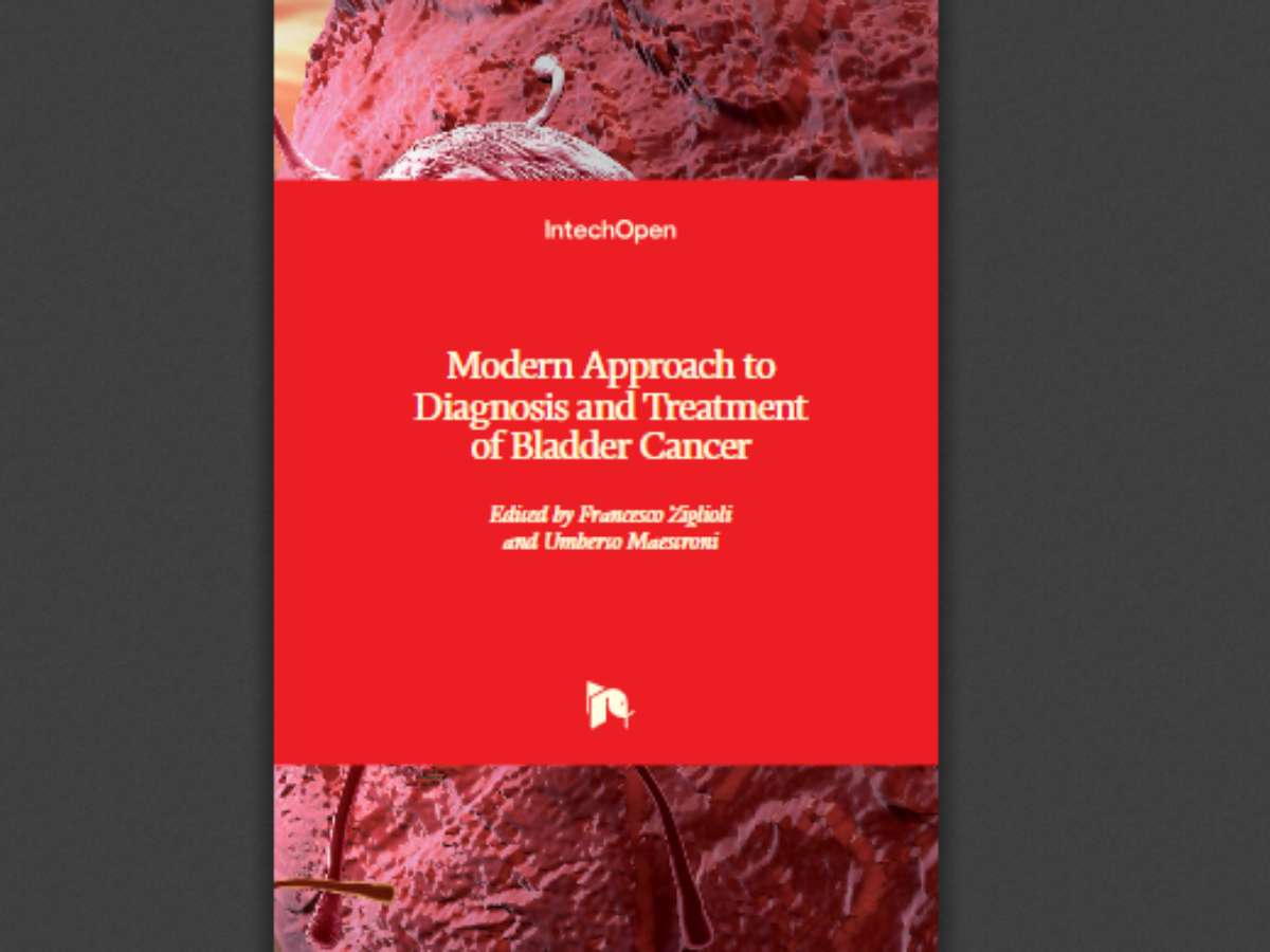 Modern Approach to Diagnosis and Treatment of Bladder Cancer
