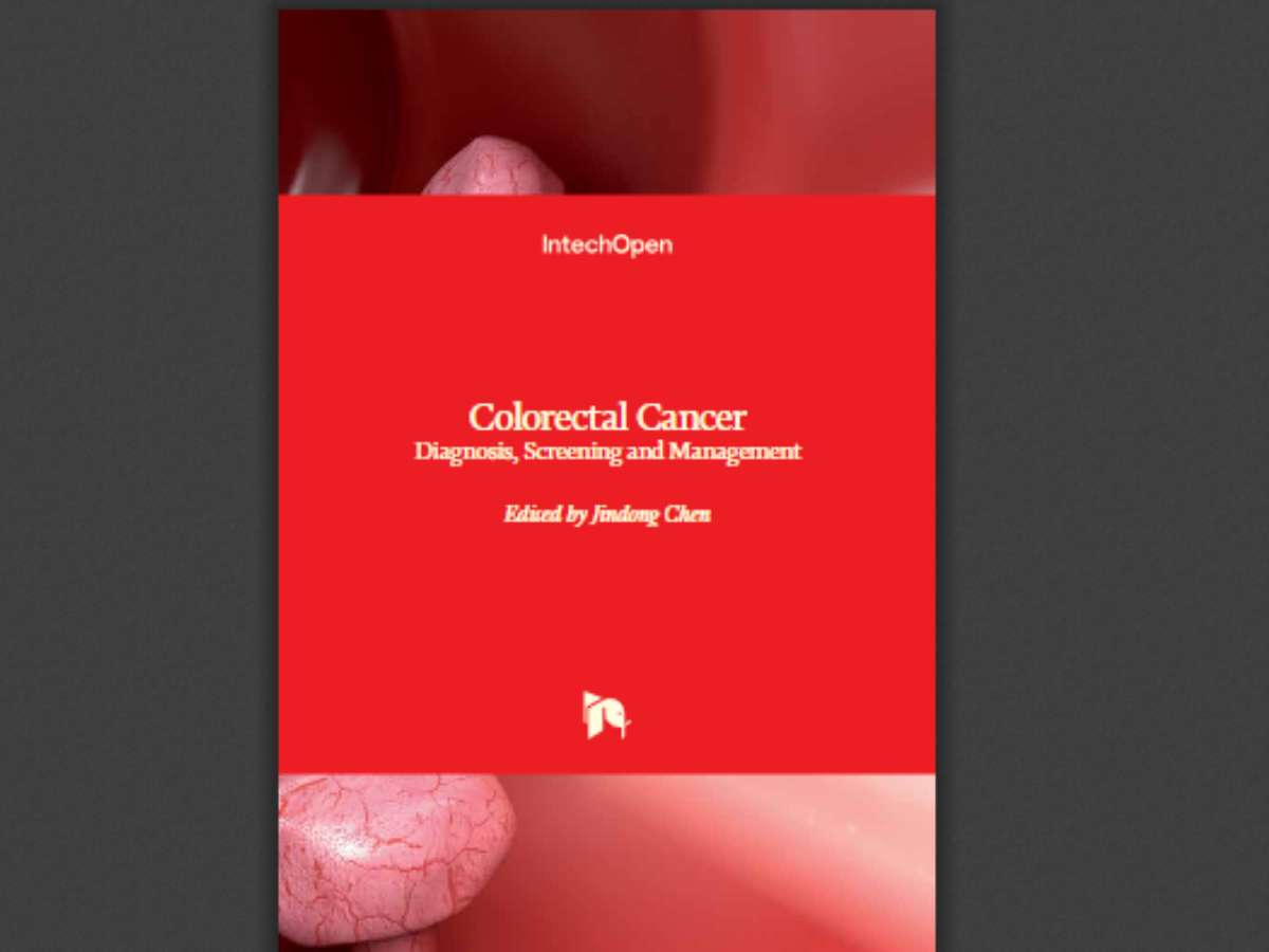 Colorectal Cancer: Diagnosis, Screening and Management