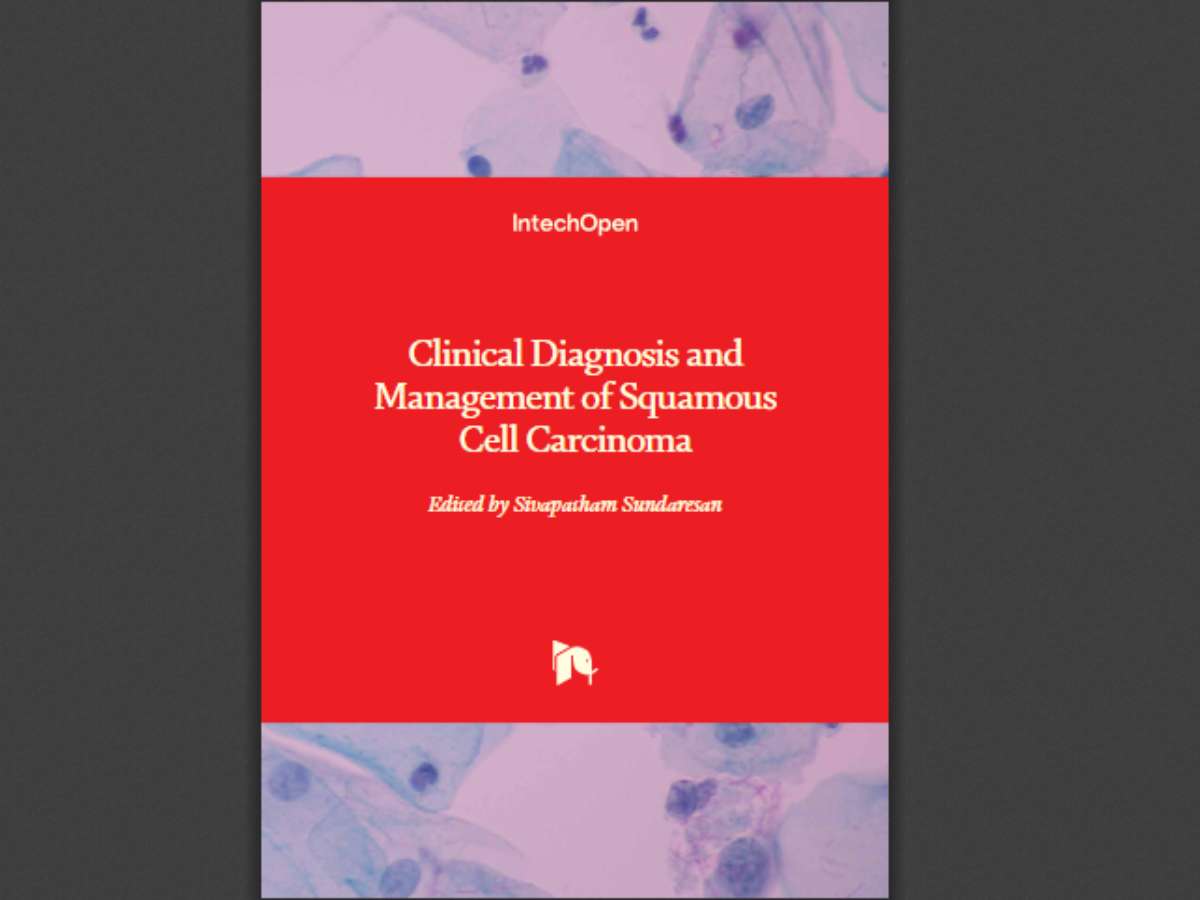 Clinical Diagnosis and Management of Squamous Cell Carcinoma