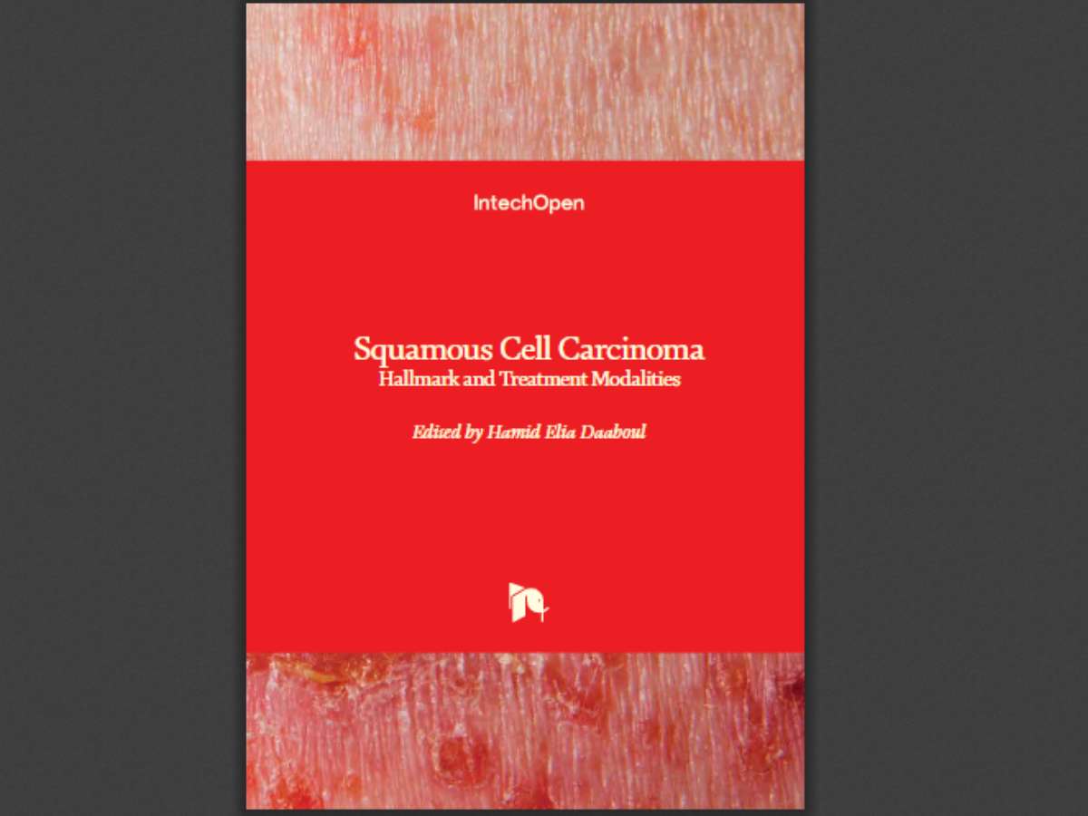 Squamous Cell Carcinoma: Hallmark and Treatment Modalities