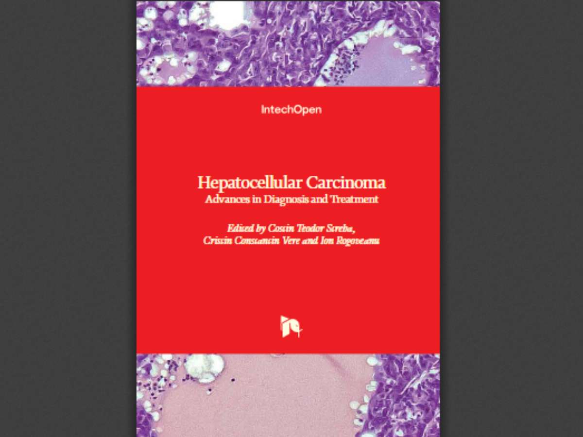 Hepatocellular Carcinoma: Advances in Diagnosis and Treatment