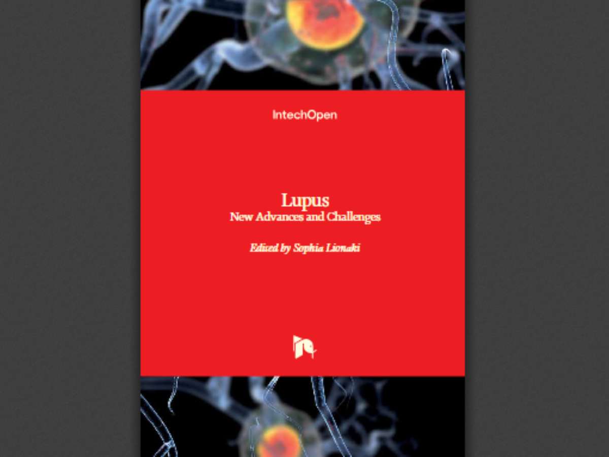 Lupus: New Advances and Challenges