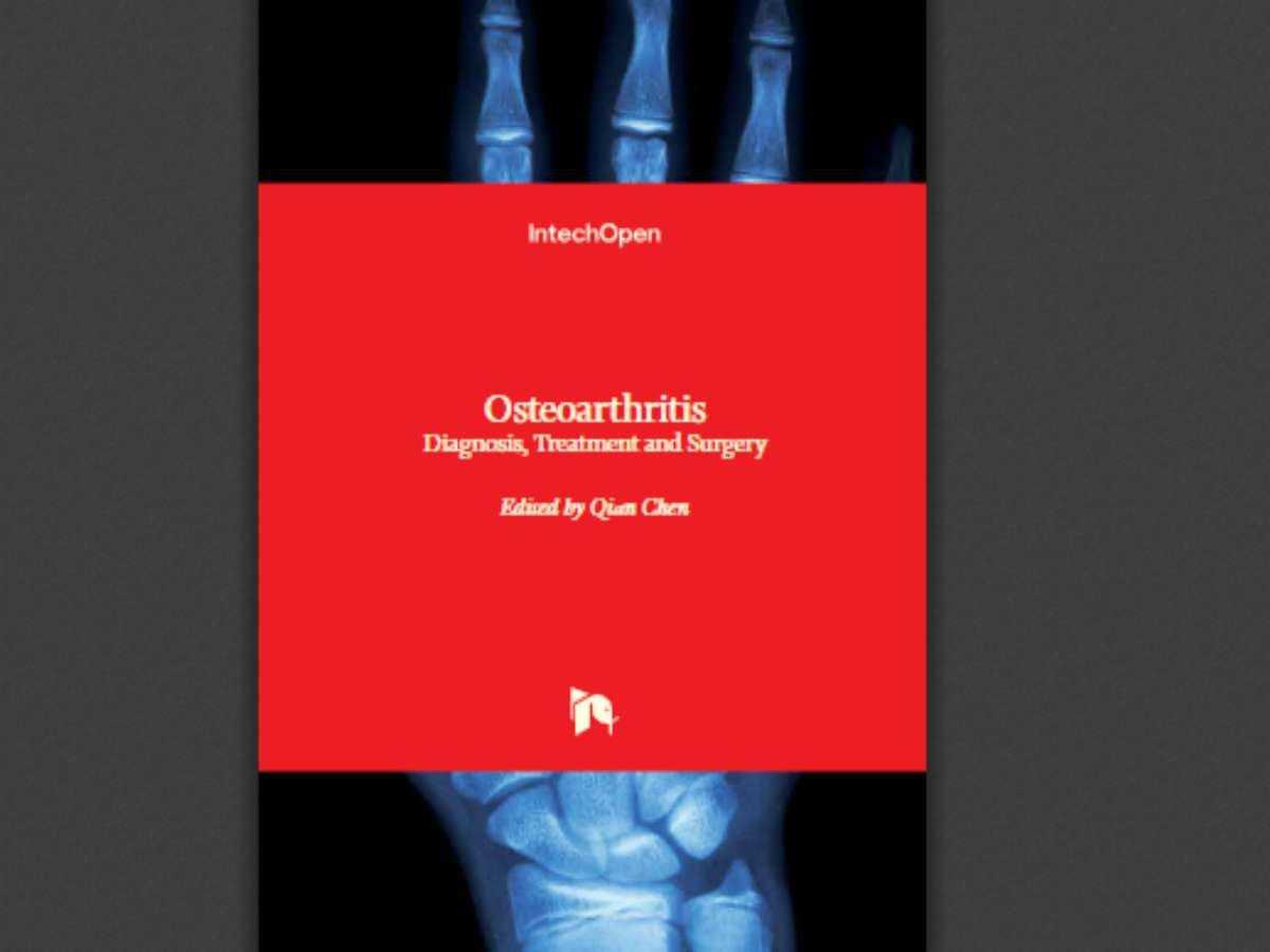 Osteoarthritis: Diagnosis, Treatment and Surgery