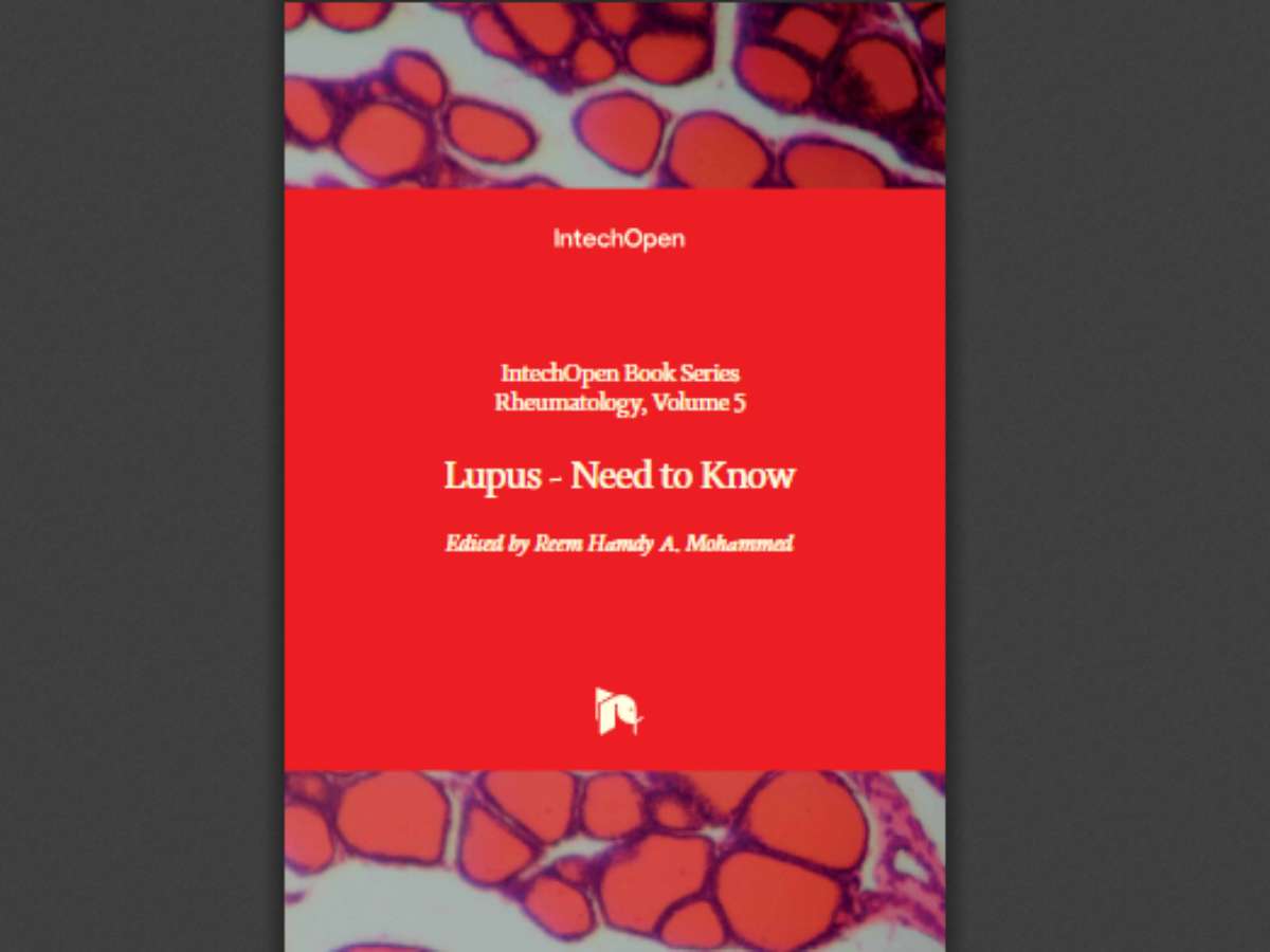 Lupus: Need to Know