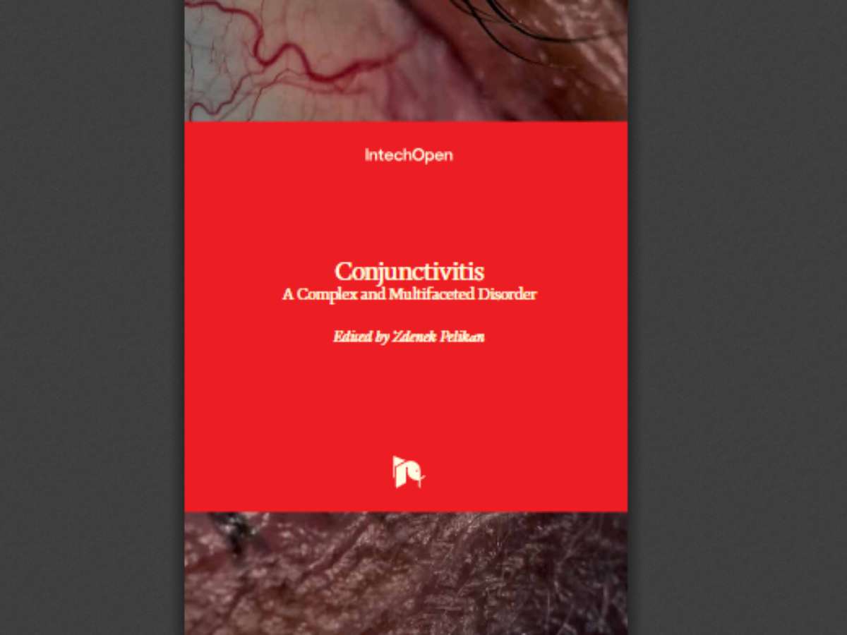Conjunctivitis: A Complex and Multifaceted Disorder